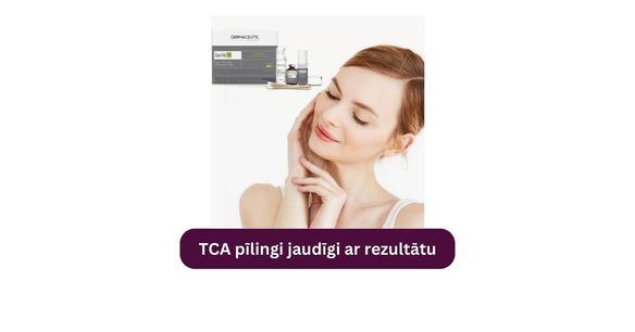 Illustrative image related to post